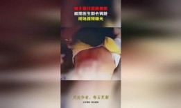 缅北医生爆料视频,战地医院的真实写照